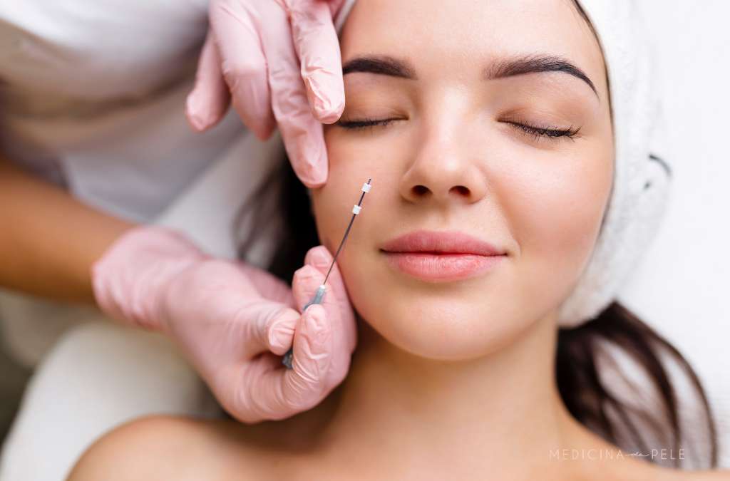 Mulher de olhos fechados recebe aplicação de fio de sustentação na pálpebra inferior por profissional com luvas rosas.