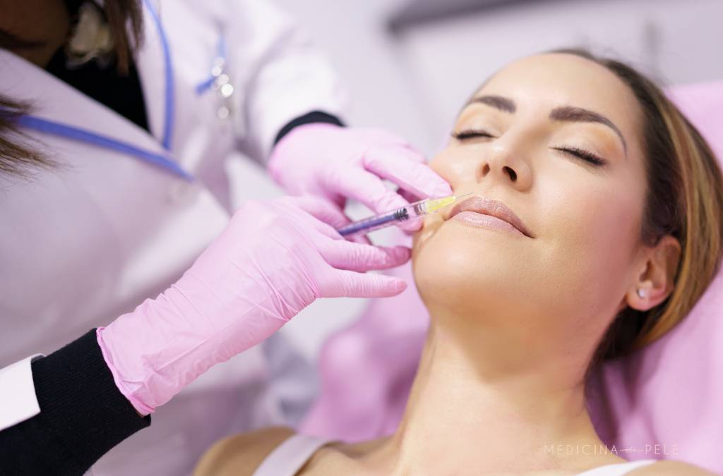 Mulher de olhos fechados recebe aplicação estética com seringa no lábio superior, realizada por dermatologista em Florianópolis, de jaleco e luvas rosas.