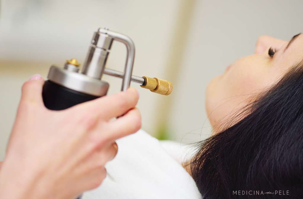Fotografia de mulher deitada recebendo jato de aparelho metálico em tratamento dermatológico facial.