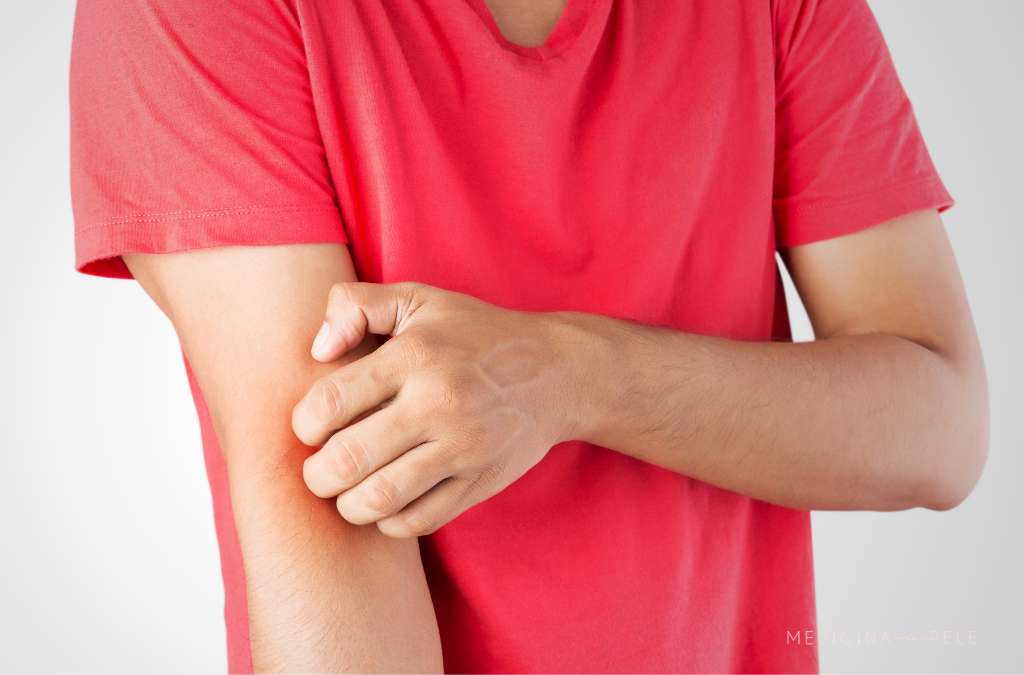 Fotografia mostra um homem vestindo camiseta vermelha coçando o braço esquerdo, sugerindo incômodo causado por dermatite atópica ou outra condição de pele irritativa.