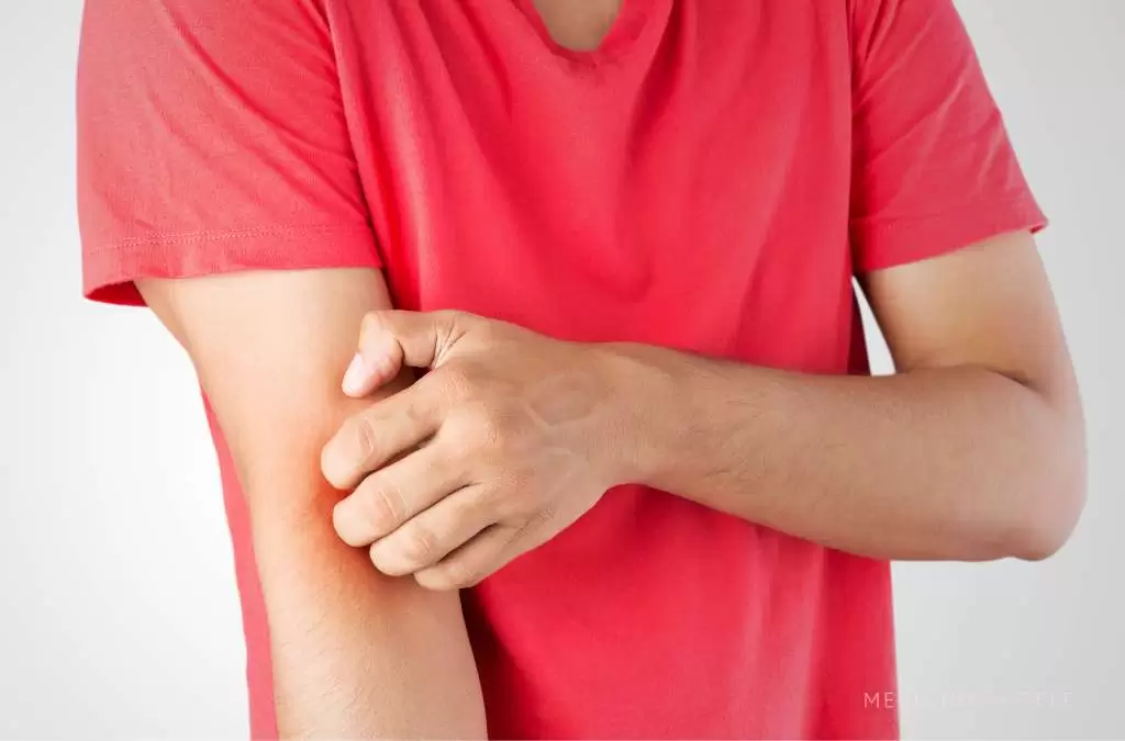 Fotografia mostra um homem vestindo camiseta vermelha coçando o braço esquerdo, sugerindo incômodo causado por dermatite atópica ou outra condição de pele irritativa.