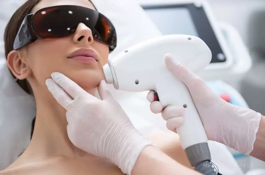 Fotografia mostra uma mulher deitada com óculos de proteção enquanto profissional aplica aparelho de laser na região do rosto, indicando procedimento estético com tecnologia Spectra XT.