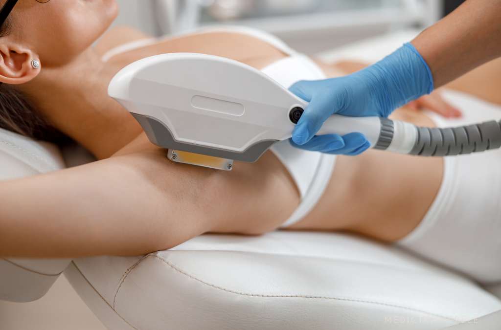 Mulher deitada com óculos e roupa íntima branca recebe depilação a laser na axila por profissional de luvas azuis.