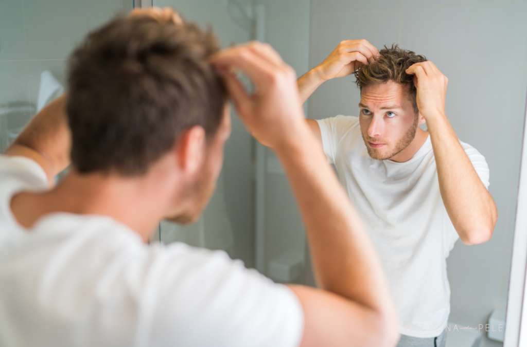 Fotografia mostra um homem em frente ao espelho examinando o couro cabeludo com as mãos, sugerindo preocupação com queda de cabelo ou calvície.