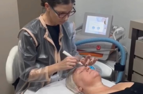 Fotografia de uma profissional de saúde aplicando ultrassom microfocado na região palpebral de uma paciente deitada em maca, com legenda “Ultrassom microfocado para a região palpebral” escrita em letras maiúsculas.